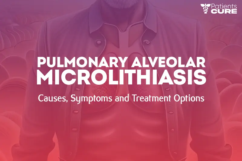 Pulmonary Alveolar Microlithiasis: Symptoms, Causes, Diagnosis &amp; Treatment